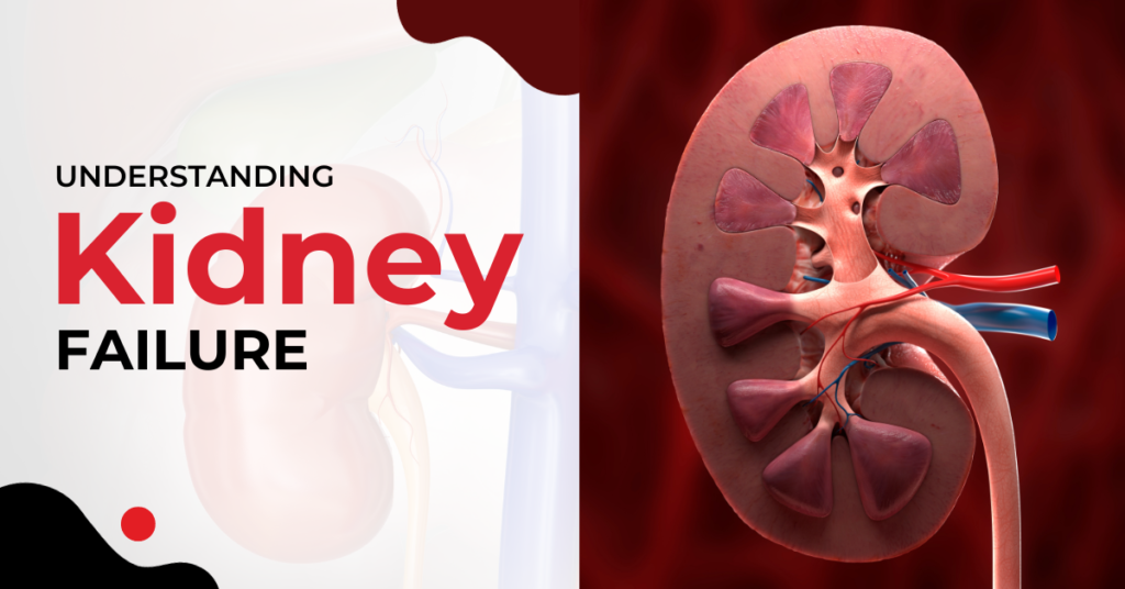 Understanding Kidney Failure
